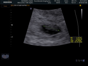 BABY_0005